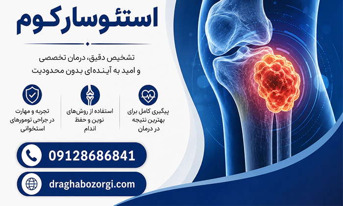 درمان استئوسارکوم