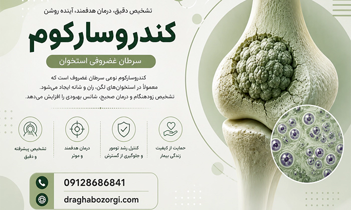 درمان کندروسارکوم