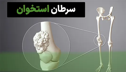 سرطان استخوان پا