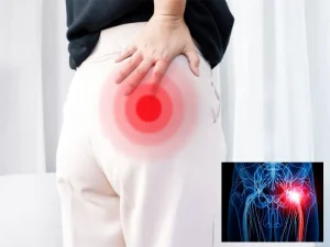 گرفتگی پیریفورمیس