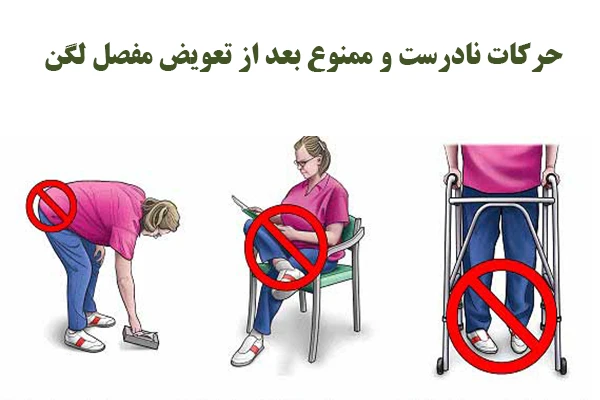 حرکات نادرست و ممنوع بعد از تعویض مفصل لگن