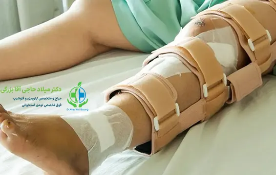 شکستگی استخوان ساق پا