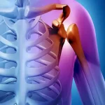 قیمت عمل تعویض مفصل شانه