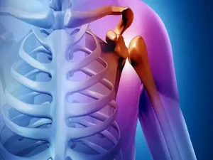 قیمت عمل تعویض مفصل شانه