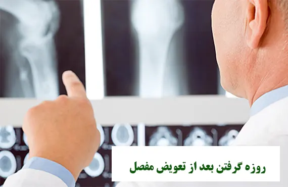 روزه گرفتن بعد از تعویض مفصل