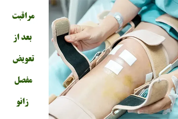 نکات مراقبتی بعد تعویض مفصل زانو