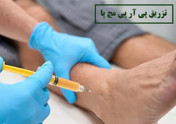 تزریق پی ار پی برای مچ پا