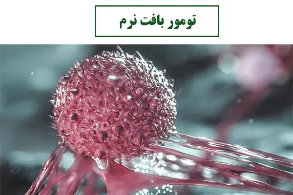 درمان تومور بافت نرم