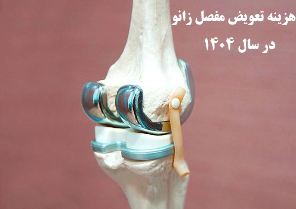 هزینه تعویض مفصل زانو