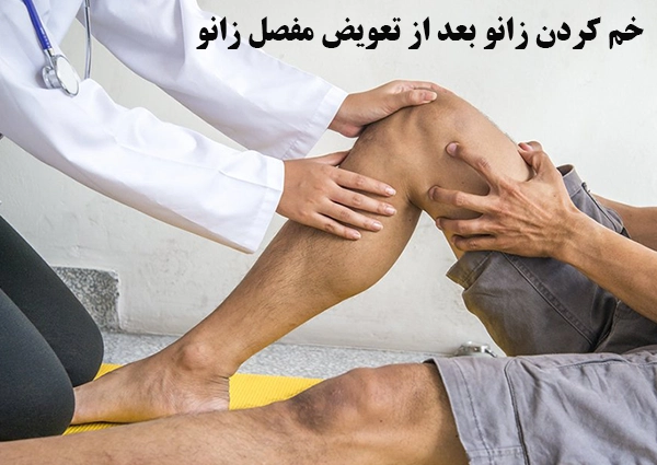 خم کردن زانو بعد از تعویض مفصل