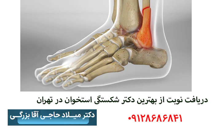 بهترین دکتر شکستگی استخوان در تهران