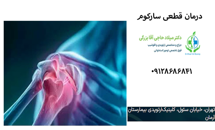 درمان قطعی سارکوم