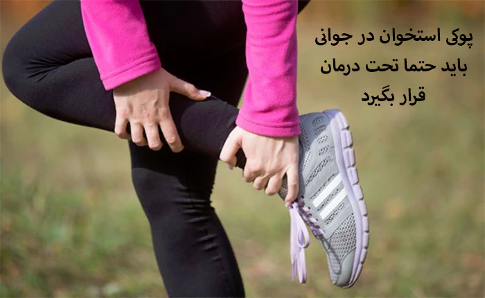 پوکی استخوان در جوانی