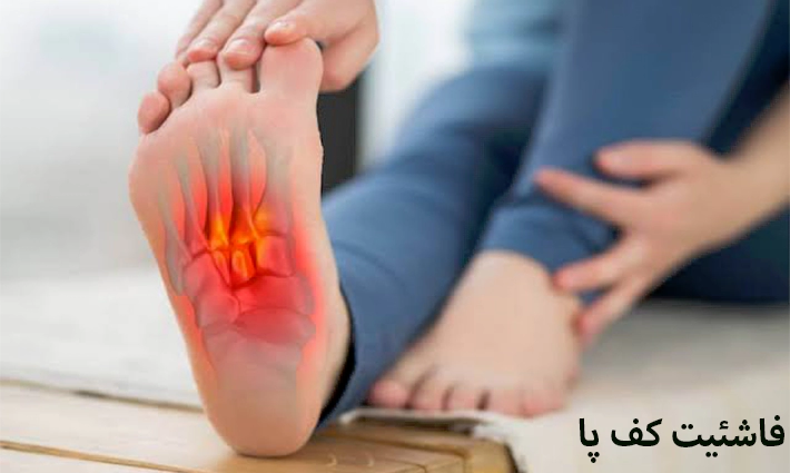 فاشئیت کف پا