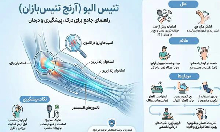 درمان تنیس البو
